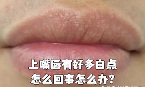 月经期间小肚和腰疼怎么回事-例假期间小腹疼腰酸怎么回事呢、经期小腹痛腰酸怎么办 -例假期间小腹疼腰酸怎么回事网